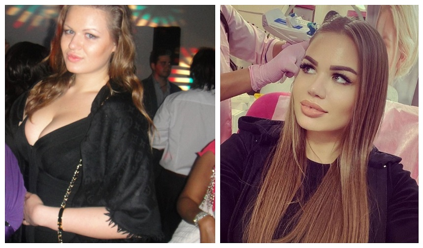 Daria Radionova, înainte de operații și după operații