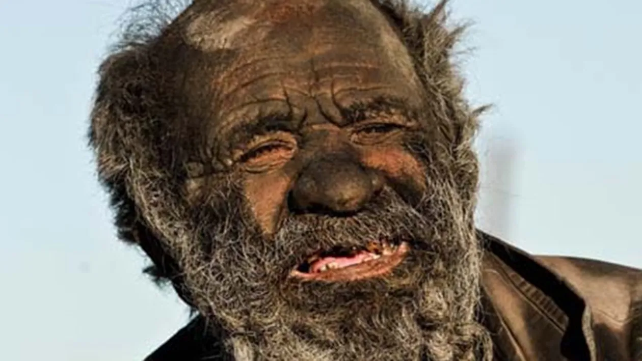 El e barbatul care nu s-a spalat de 60 de ani! Imaginile care au facut inconjurul lumii