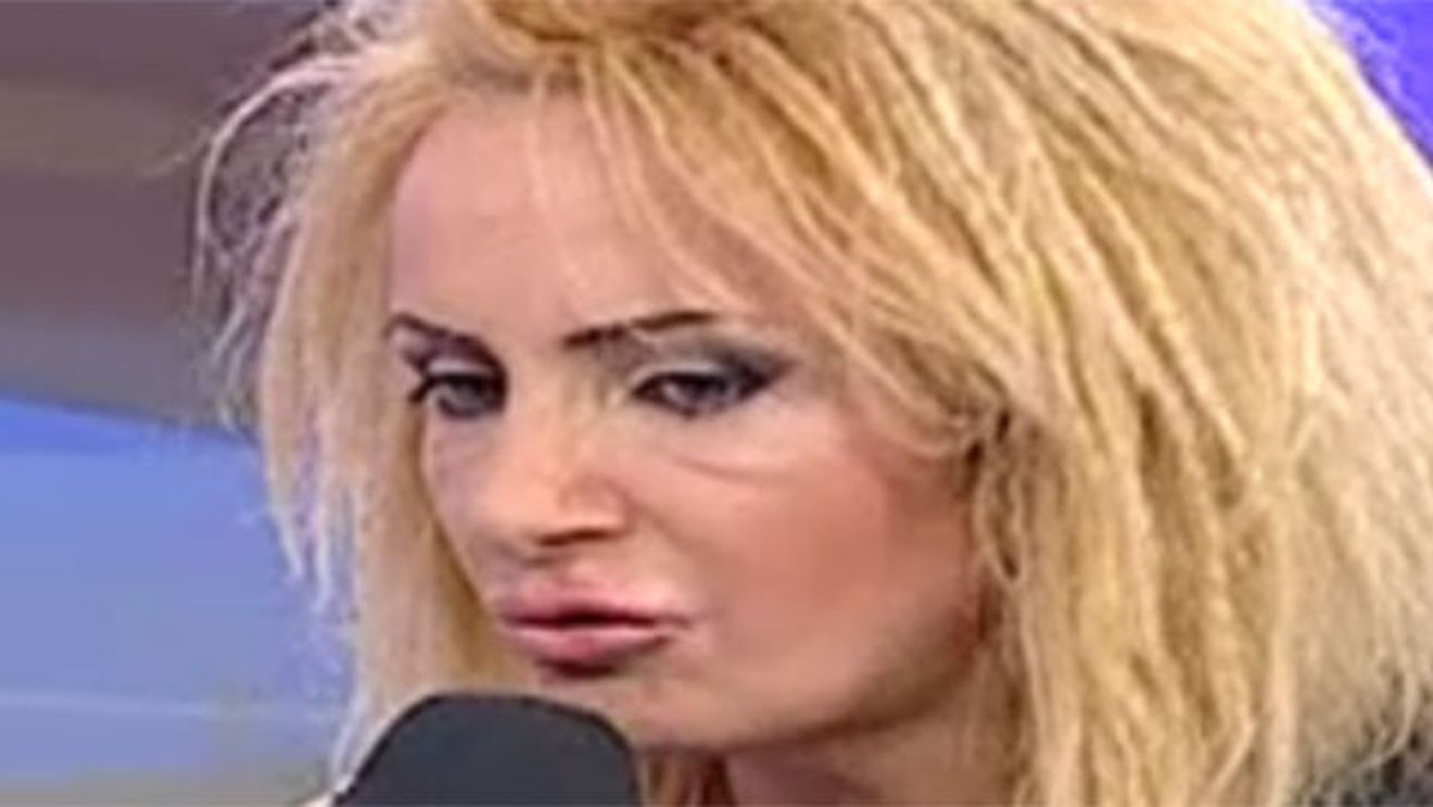 Arata HORROR! Daniela Gyorfi, de nerecunocut! Fata artistei s-a deformat complet din cauza operatiilor estetice!