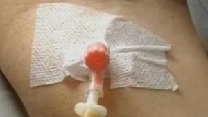 Un tanar din Sibiu a fost muscat de o capusa si acum este suspect de encefalita!