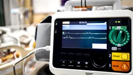 Puls sub 60 de bătăi pe minut? Cardiologii explică când este perfect normal și când poate ascunde o problemă de ritm cardiac