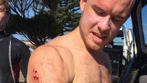 VIDEO / Un medic a bătut rechinul care a încercat să-i mănânce braţul drept: "L-am lovit cât de tare am putut şi apoi..."
