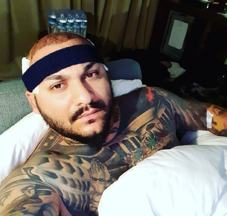 Să vezi și să nu crezi! Cum arată Dani Mocanu, după implantul de păr: „Ai dat banii de pomană, zici că ești…”