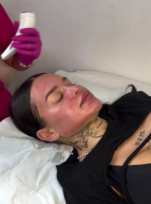 Diandra s-a filmat în timpul unui tratament facial/ Sursa foto: Instagram