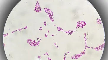 O boală veche de milenii devine tot mai rezistentă la antibiotice. Avertismentul cercetătorilor