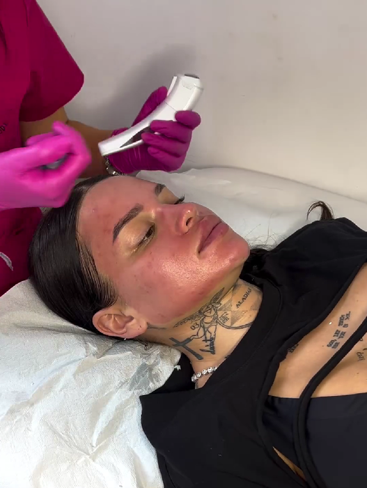 Diandra s-a filmat în timpul unui tratament facial/ Sursa foto: Instagram