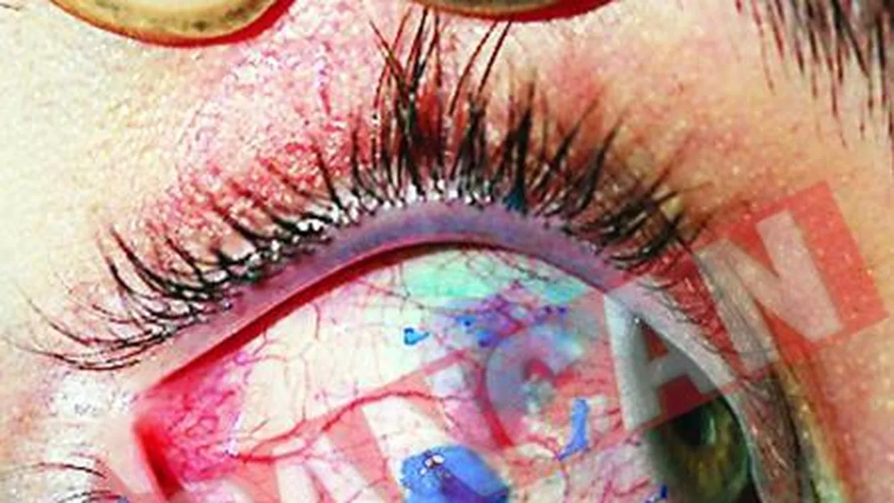 Primul tatuaj pe pupila