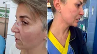 Scene halucinante. O asistentă de la ATI, bătută de o colegă de spital din gelozie