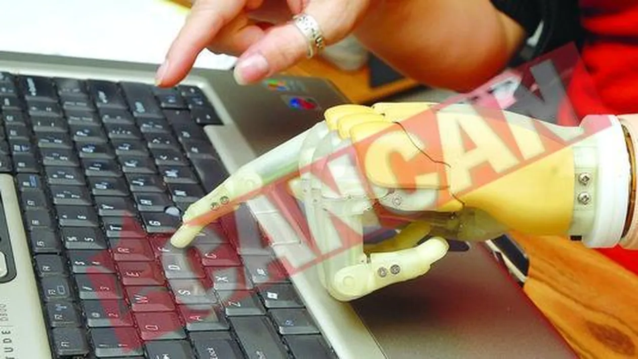 Prima mana artificiala flexibila