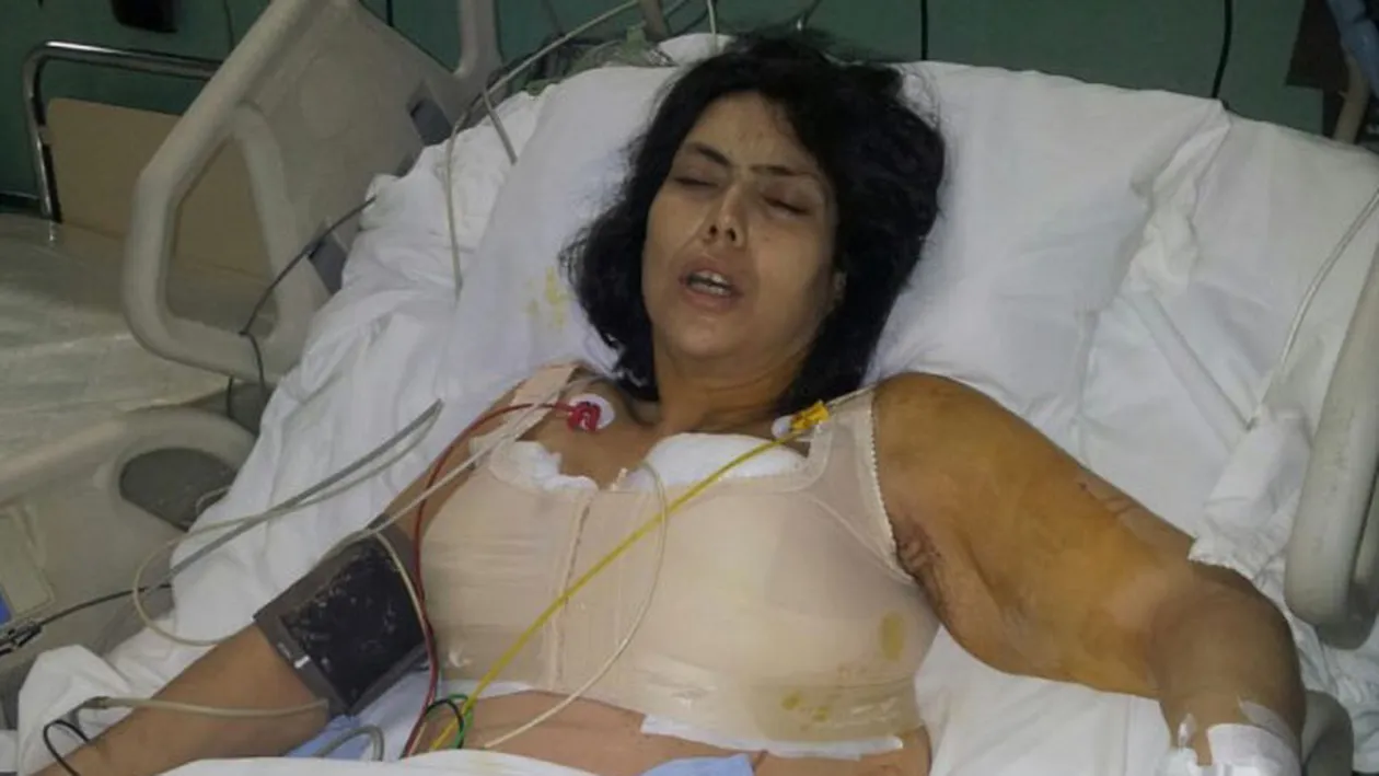 Ioana Tufaru a marturisit prin ce chinuri trece de cand si-a remodelat sanii: E infectata cusatura