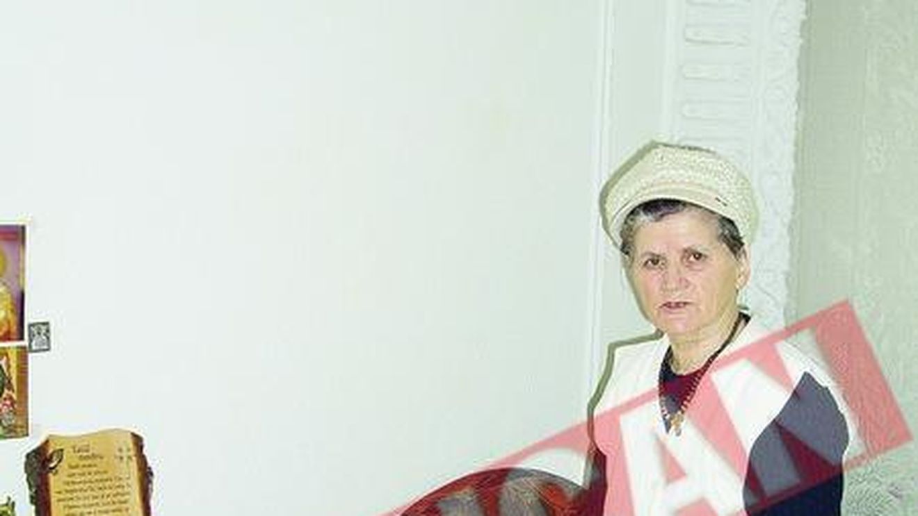 O femeie traieste cu jumatate de craniu