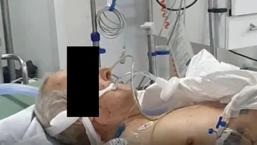 Un pacient infectat cu coronavirus a fost internat trei zile la o secţie de terapie intensivă non-COVID din Spitalul Județean Craiova. Acum se caută vinovații