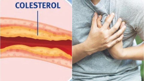 Dieta de doar 2 zile care contribuie la scăderea colesterolului. Cercetătorii germani o recomandă