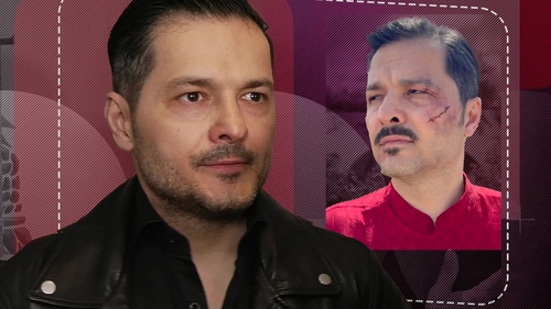 În ce stare se află Liviu Vârciu, după accidentul neaşteptat. Ce tratament strict i-au prescris medicii: “Un milimetru și îmi pierdeam ochiul”