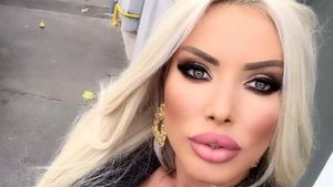 Loredana Chivu a ajuns din nou pe mâna medicului. La ce procedură a mai apelat blondina, pentru a demonstra că o ține buzunarul