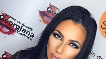 Roxana Vancea a ajuns pe mâna medicului: ”Am stat cu capul umflat...”