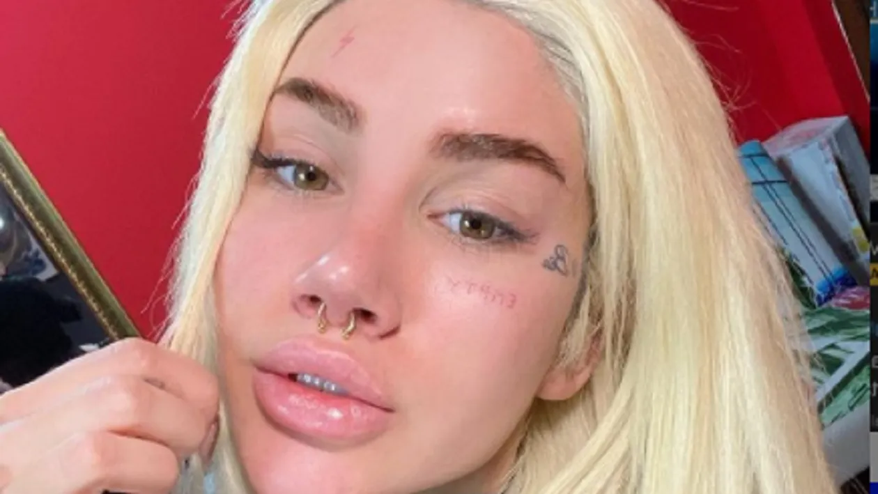 Bia Khalifa a bifat o nouă operație estetică! Ce i-a spus Dani Mocanu