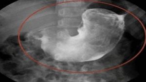 S-a dus la medicul ginecolog, iar diagnosticul a lăsat-o fără cuvinte! Ce a pățit o femeie care obișnuia să doarmă în pat cu pisicile ei