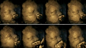 Fumezi in timpul sarcinii? Trebuie sa vezi asta! Cum reactioneaza fatul cand mama lui isi aprinde o tigara