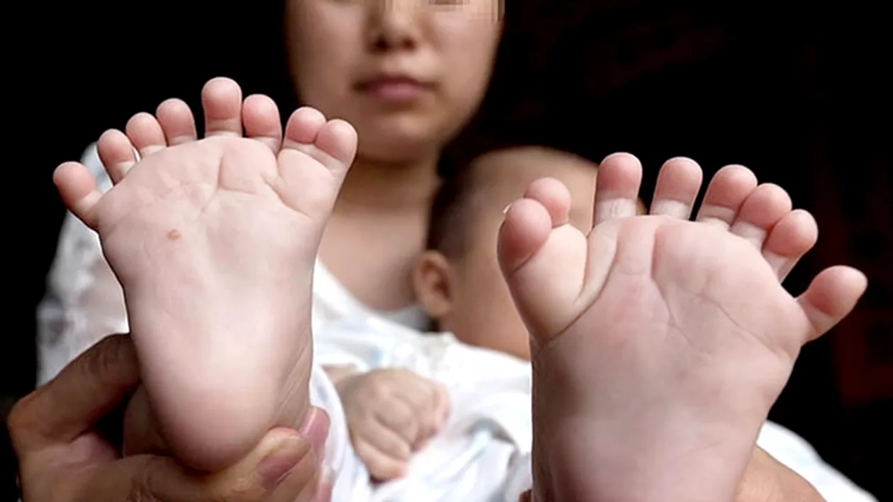 Era în culmea fericirii că va deveni mămică, dar când şi-a văzut copilul după naştere a început să plângă: bebeluşul avea 31 de degete! Uite cum arată 