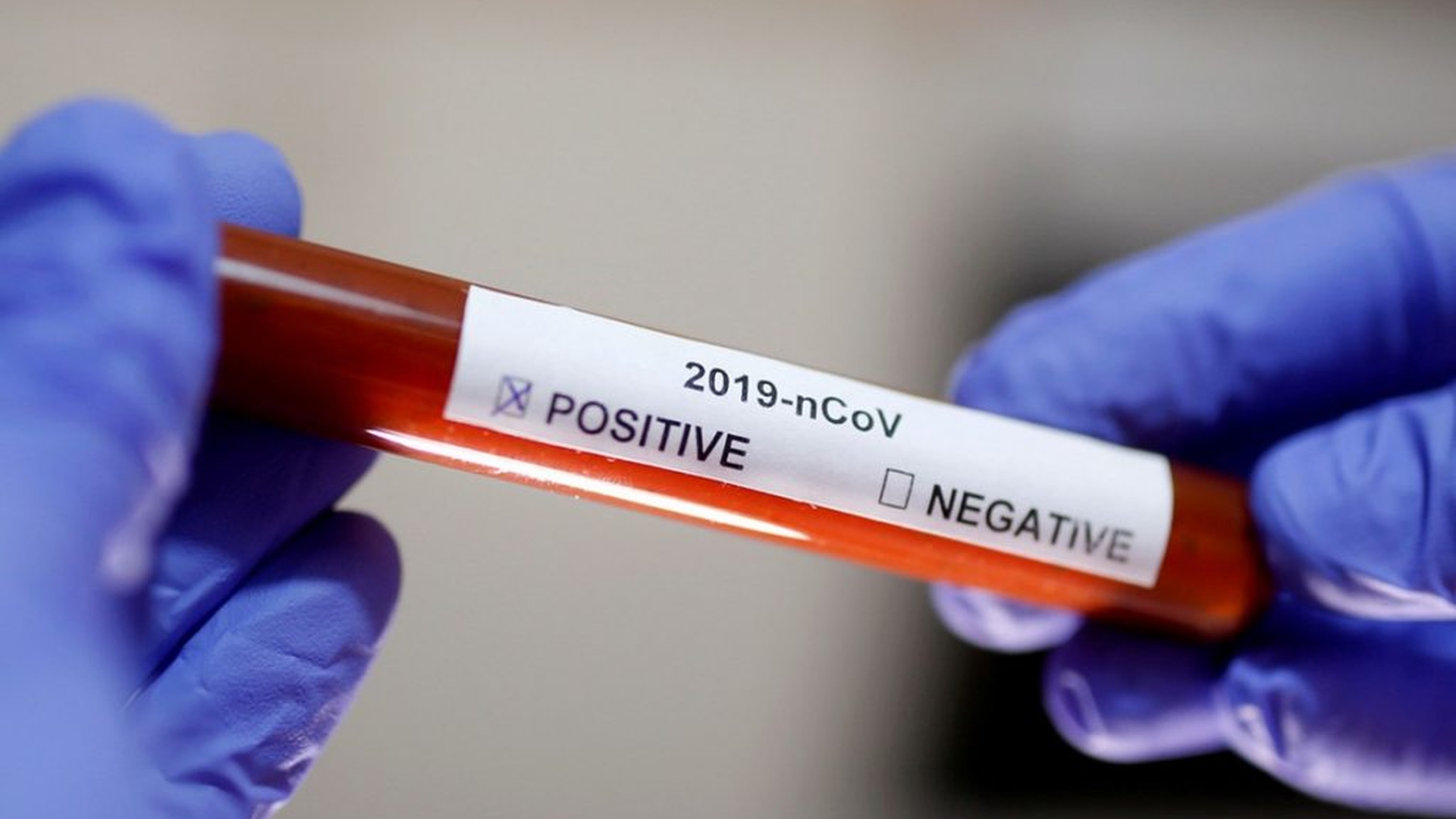 Numărul deceselor cauzate de coronavirus în SUA a crescut din nou!