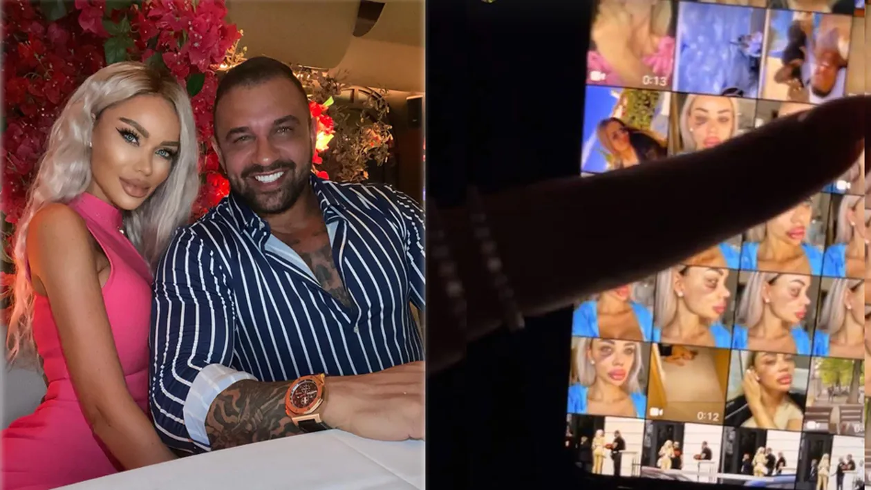 Bianca Drăgușanu a publicat mai multe imagini după ce a fost snopită de Alex Bodi: “Pentru pozele în care apar bătută, am depus o plângere penală” | FOTO