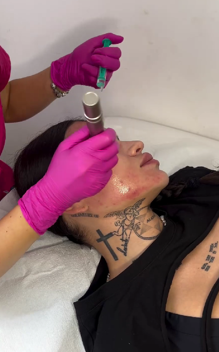 Diandra s-a filmat în timpul unui tratament facial/ Sursa foto: Instagram