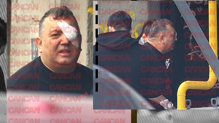 Primele & singurele imagini cu faimosul Beinur după ce a fost împușcat!