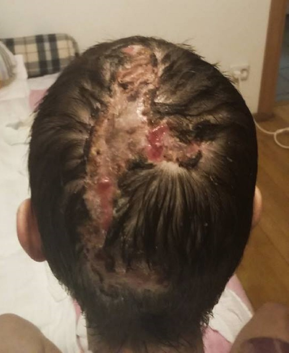 Reacţia lui Codin Maticiuc după textul cutremurător scris de Alexandra Furnea, supravieţuitoare Colectiv: „Dacă locuiţi în România cred că…”