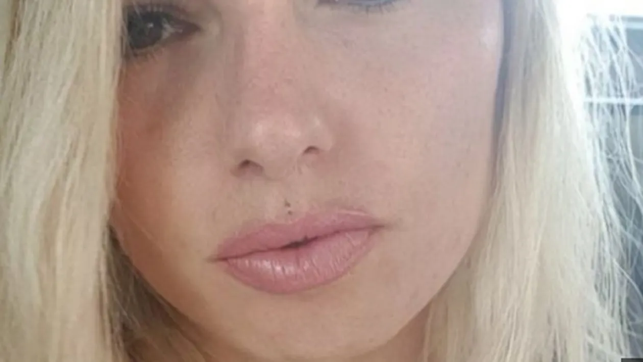 Au ucis-o două operații estetice făcute la un loc! Drama unei femei de 36 de ani