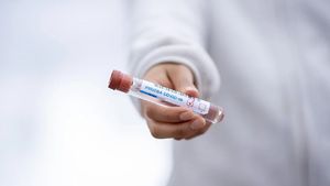 Bilanț decese coronavirus, 10 aprilie 2021. Numărul persoanelor care au murit din cauza infectării cu COVID-19, de la ultima informare