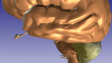 Un creier vechi de 2.500 de ani, perfect conservat, a fost descoperit