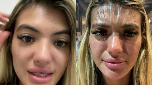 O tânără de 25 de ani a adormit pe plajă, în vacanță. Când s-a trezit a avut un șoc și a mers de urgență la medic