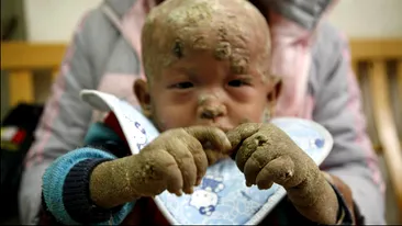 Copilul-peste i-a uimit pe doctori