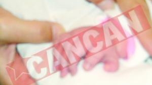 S-a nascut cu sase degete la o mana