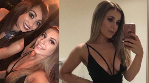 Şi-a pierdut piciorul într-un accident teribil, acum e model la Londra! Povestea emoţionantă a tinerei