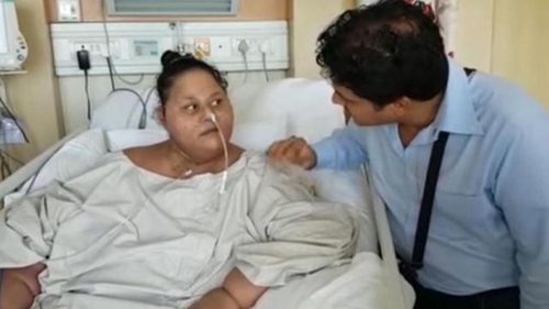 Aceasta e cea mai grasă femeie din lume şi cântărea jumătate de tonă! Cum a ajuns să arate acum, după ce a fost operată