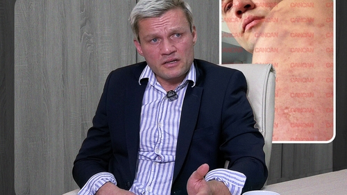 Super-modelul Andre Bîrleanu rupe tăcerea, după acuzațiile fostei partenere: „Am fost bătut”