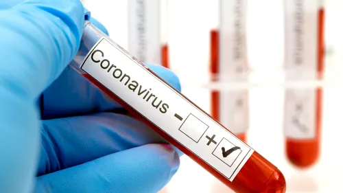 Coronavirus România, 20 februarie. 57 de decese s-au înregistrat în ultimele 24 de ore