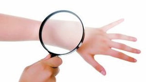 O Boala misterioasa produce rani ale pielii