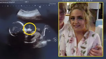 A rămas însărcinată la doar 16 ani și a mers să facă o ecografie. Ce ciudățenie a văzut lângă bebelușul ei