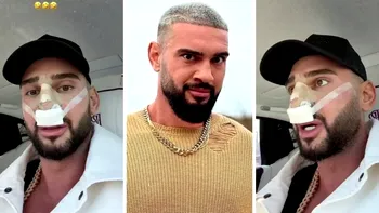 Dorian Popa și-a dat bandajele de la nas jos: „Am plâns ca un bebeluș.” Care este motivul?