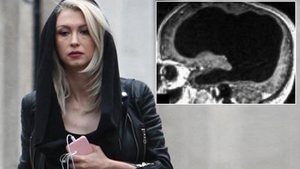 Andreea Bălan, complicații după stop-cardiac. A fost creierul afectat?! "Am făcut două RMN-uri"