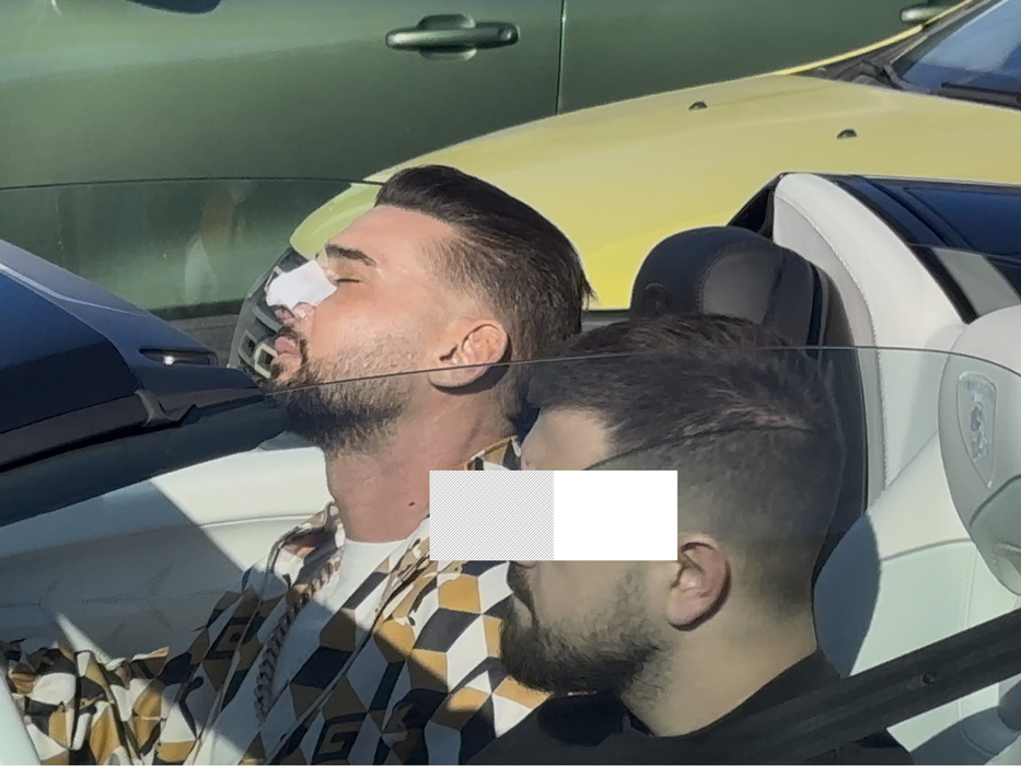 Cântărețul era însoțit de un prieten care conducea