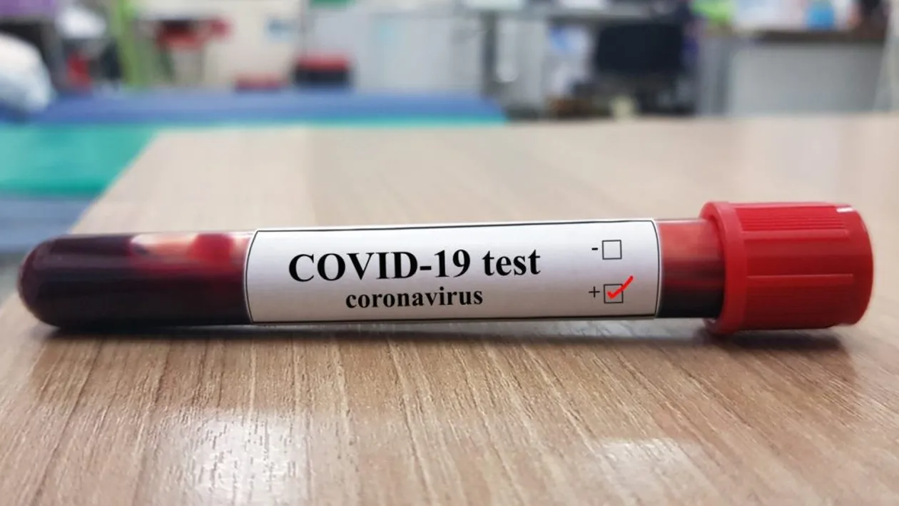Coronavirus în România! Au fost raportate încă șase decese. Bilanțul negru ajunge la 1.276