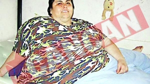 Obezul lumii, lovit de o copertina