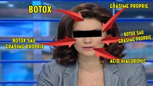 Pana si ea a pierdut sirul interventiilor estetice! Ultima aparitie publica a unei prezentatoare TV a socat pe toata lumea!