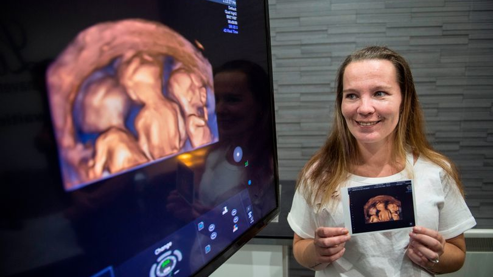 Isi mai dorea un bebelus, desi i-a fost interzis categoric acest lucru! A ramas insa insarcinata si medicii au inceput sa planga atunci cand femeia a mers sa nasca