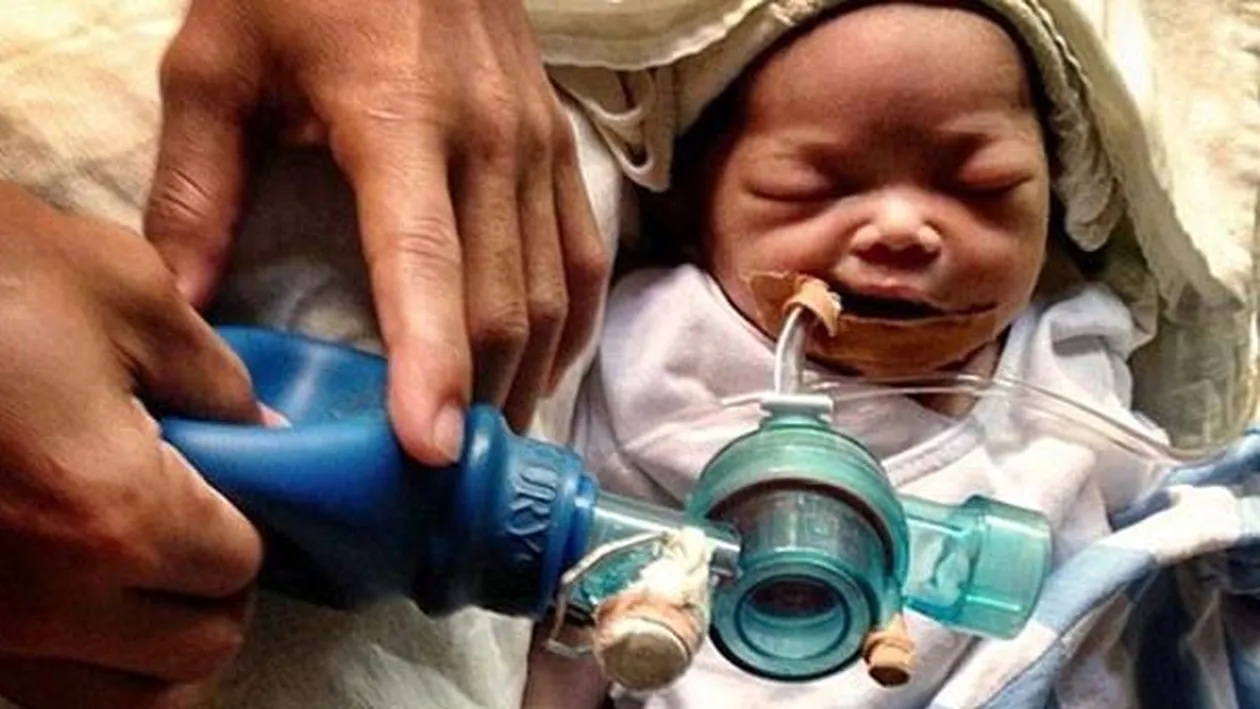 Lacrimi de durere pentru o mama! Sacrificiul suprem facut de ea pentru a-si salva fetita