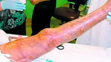 Meduza era sa ma omoare